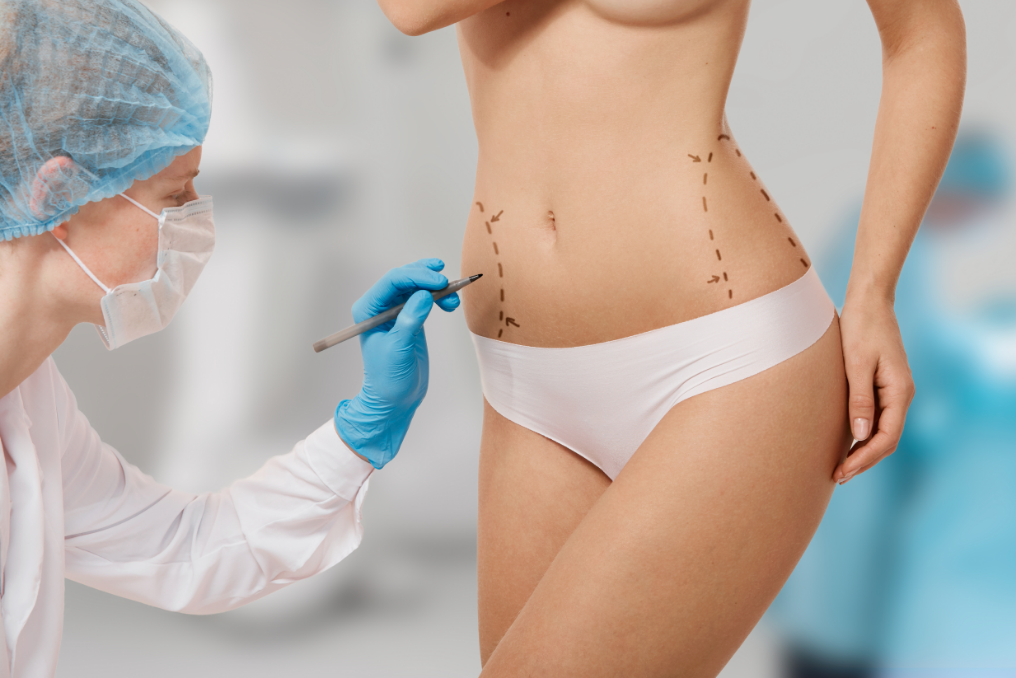 woman-marked-out-cosmetic-surgery (1)